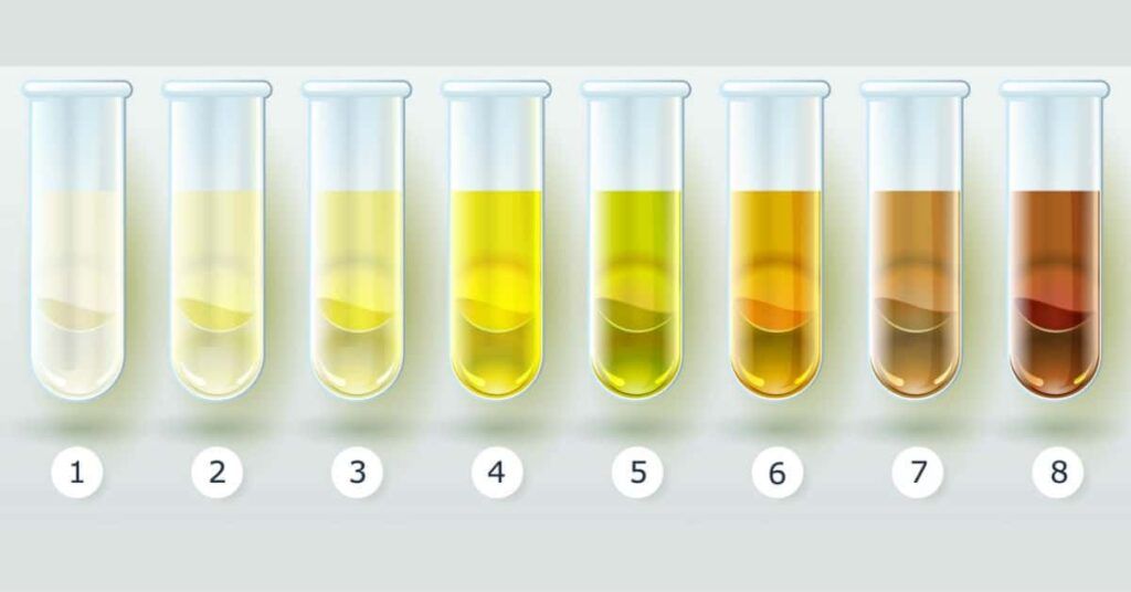 トラタミエント